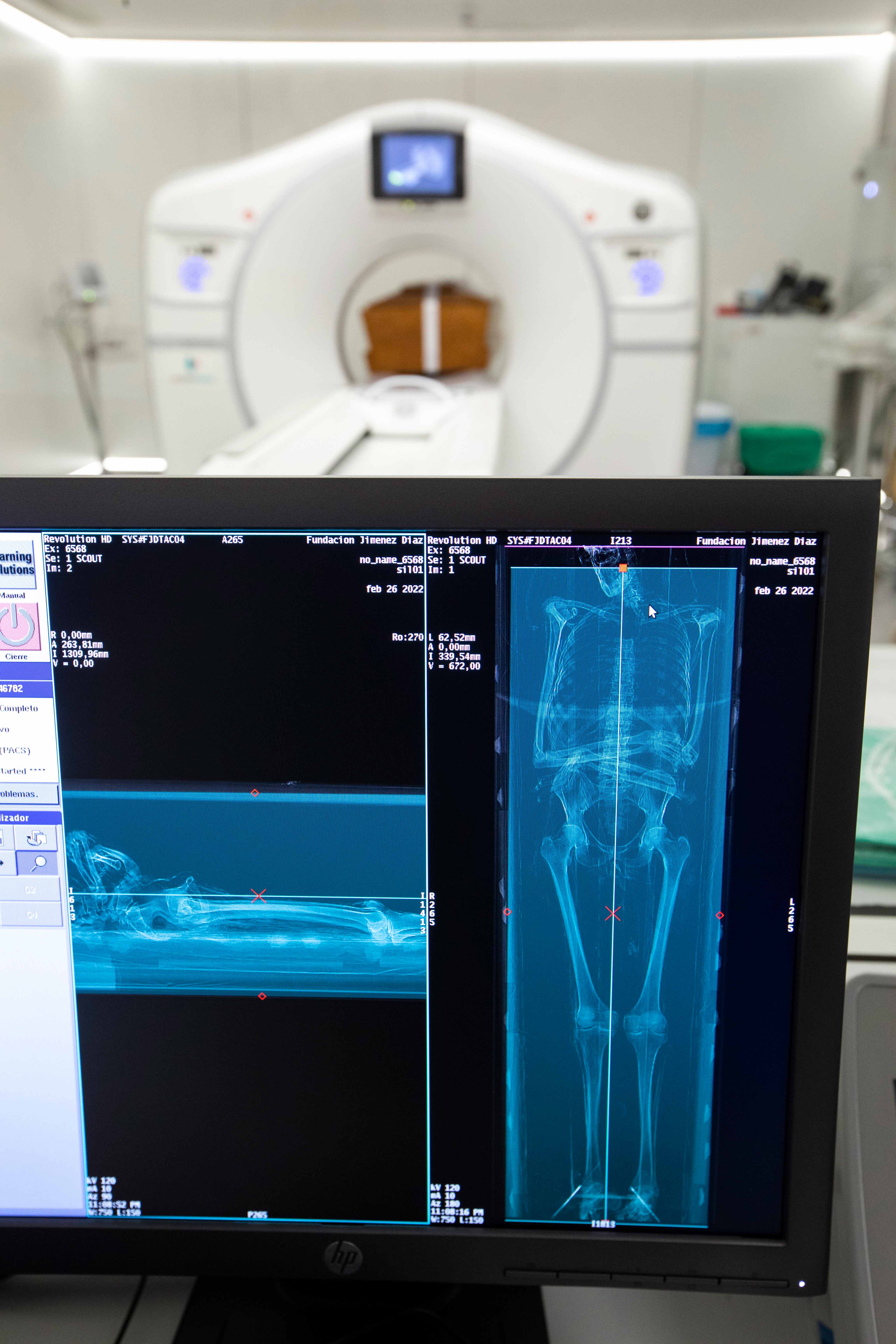 2022-11-28 - Estudio forense del cuerpo de san Isidro