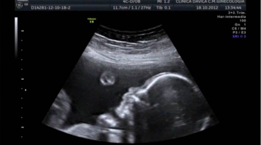 Estudio demuestra que los beb&eacute;s en el vientre pueden reconocer rostros humanos