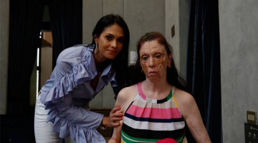 Sabe que sufrir&aacute; enfermedad degenerativa, pero su fe le ayuda a levantarse cada d&iacute;a